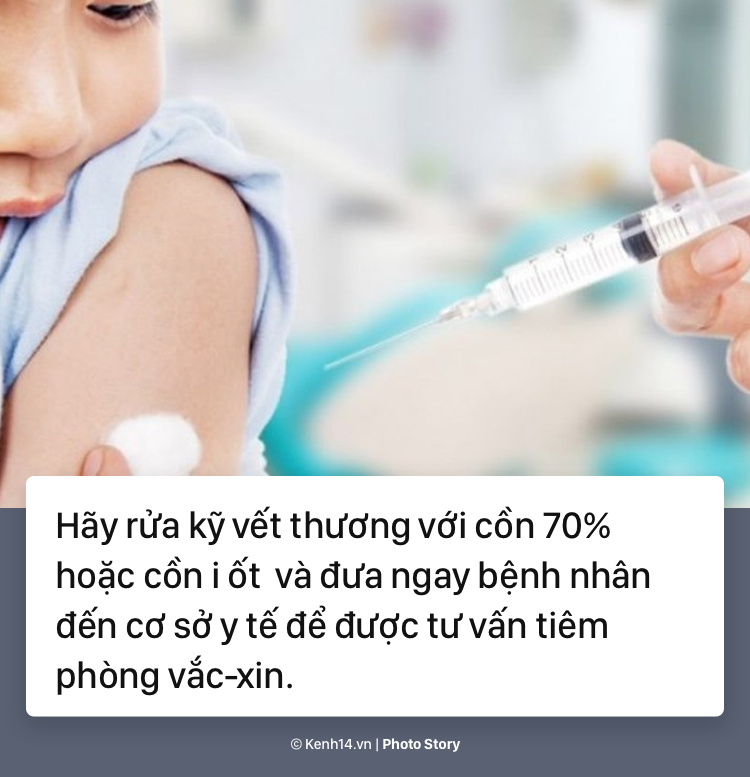 Trước liên tiếp những vụ chó tấn công trẻ em gần đây, tìm hiểu cách sơ cứu vết thương kịp thời - Ảnh 9.