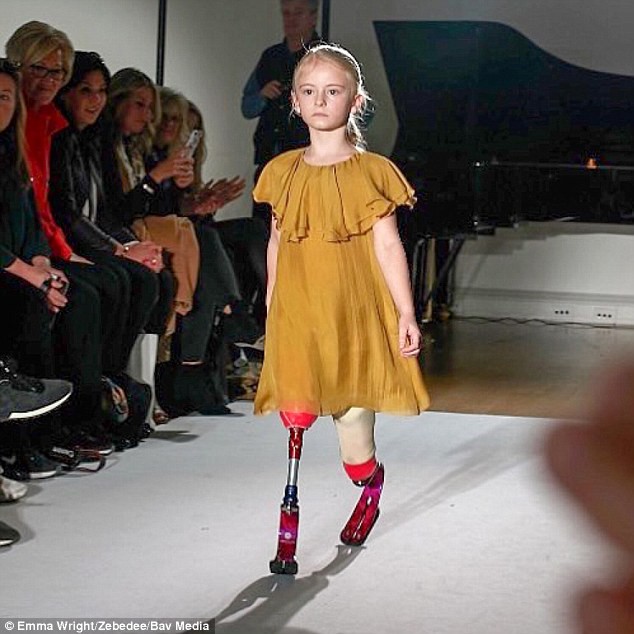 Bị cắt cụt cả 2 chân khi mới 18 tháng tuổi, bé gái tự tin sải bước trên sàn catwalk khiến người người nể phục - Ảnh 3.