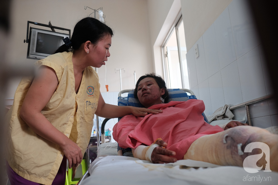 Lên Sài Gòn làm việc phụ mẹ nuôi em, thiếu nữ 18 tuổi bị bình gas mini làm bỏng nặng - Ảnh 9.