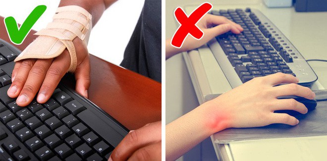 Bị tê tay vào ban đêm là dấu hiệu cảnh báo hội chứng ống cổ tay rất nguy hiểm - Ảnh 3. Bị tê tay vào ban đêm là dấu hiệu cảnh báo hội chứng ống cổ tay rất nguy hiểm - Ảnh 3.