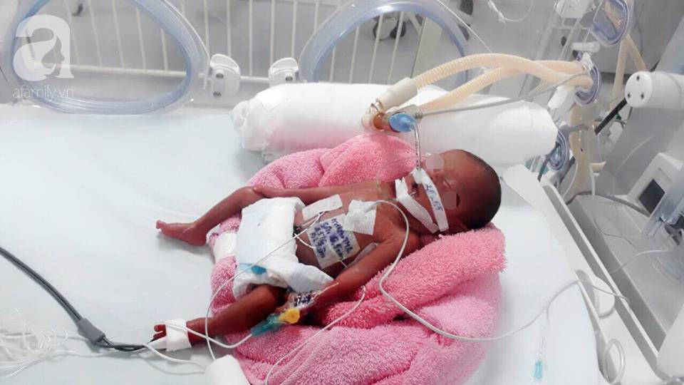 TP.HCM: Bé gái sơ sinh nặng chỉ 600 gram, tổn thương tim nguy kịch được cứu sống thần kỳ - Ảnh 1.