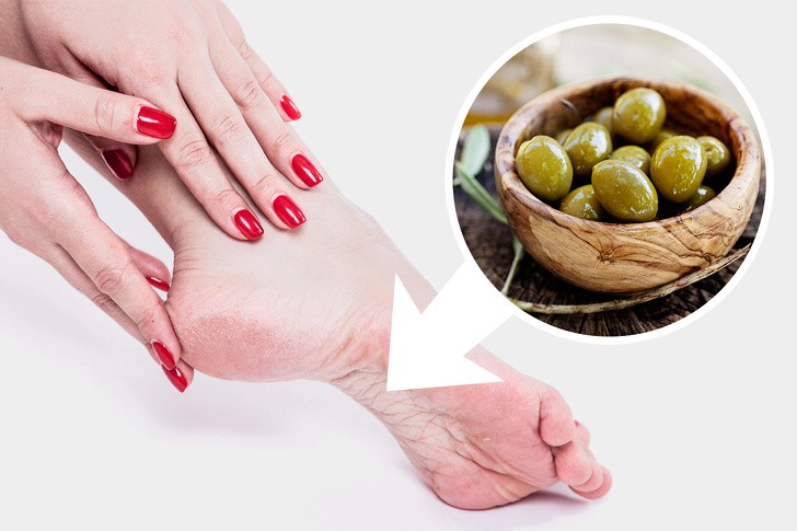 10 mẹo dưỡng da chân vừa dễ thực hiện lại hiệu quả cao, chị em hãy thử để sở hữu đôi bàn chân nuột nà - Ảnh 3.