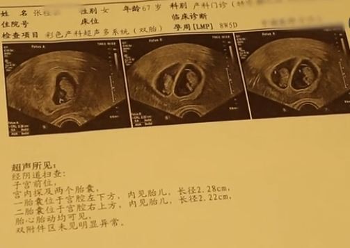 Thai phụ 67 tuổi bị bệnh viện từ chối thẳng thừng, biết được lý do bà đánh cược mạng sống để sinh con, ai cũng cảm động đến rơi lệ - Ảnh 2. Thai phụ 67 tuổi bị bệnh viện từ chối thẳng thừng, biết được lý do bà đánh cược mạng sống để sinh con, ai cũng cảm động đến rơi lệ - Ảnh 2.