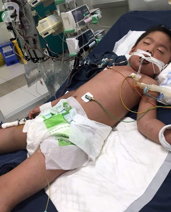 Hà Nội: Bé trai 7 tuổi đang khỏe mạnh bỗng hôn mê vì suy đa tạng, nhiễm trùng máu sau trận sốt cao - Ảnh 3.