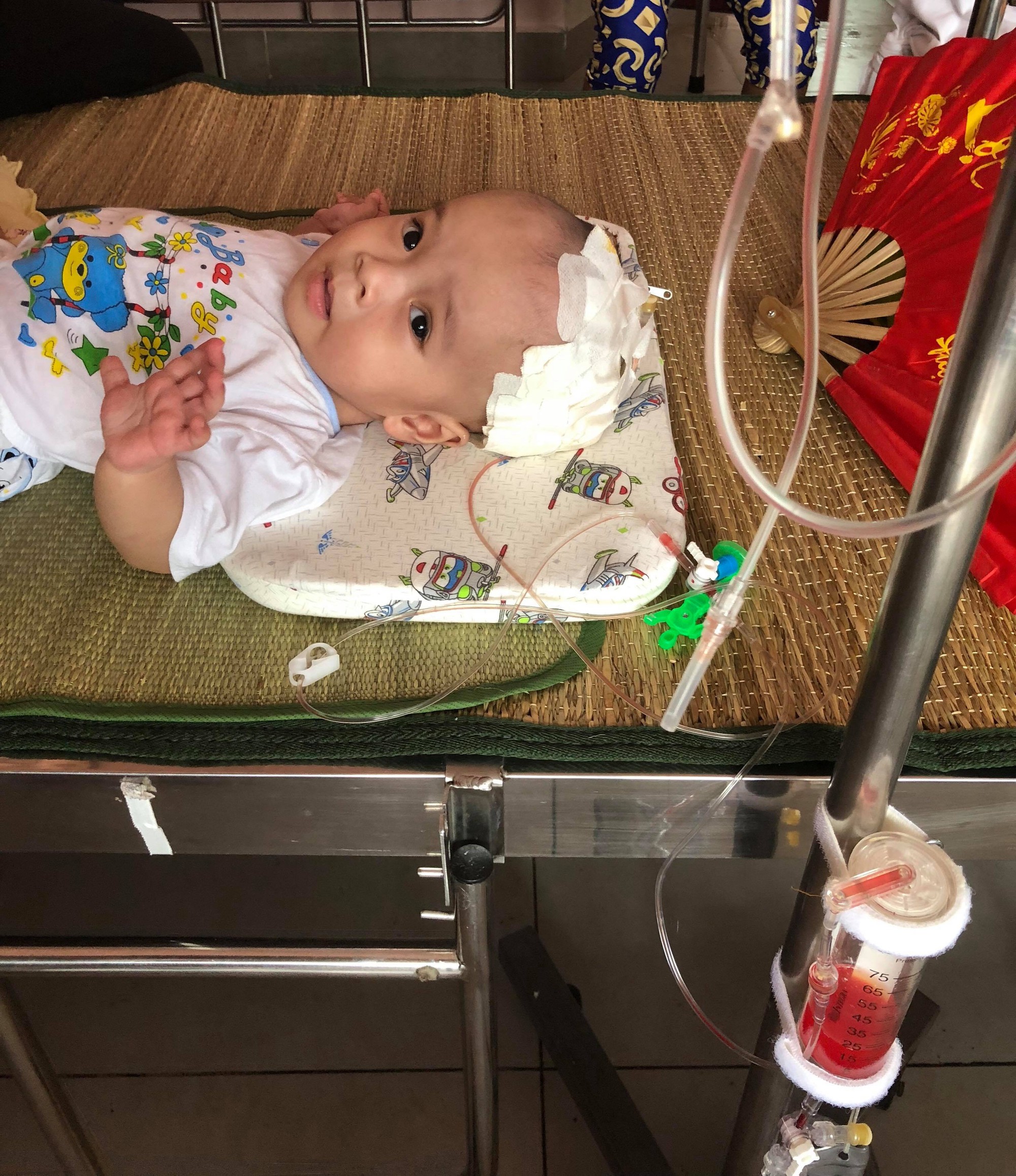 Tiếng khóc thương tâm của bé trai 10 tháng tuổi mắc bệnh não úng thủy ở Nghệ An - Ảnh 2.