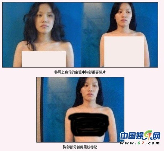 Gái ế Kim Ah Joong: 14 năm không mảnh tình vắt vai, thị phi đủ đường từ scandal ảnh nóng, dao kéo đến tin đồn đột ngột qua đời - Ảnh 6.