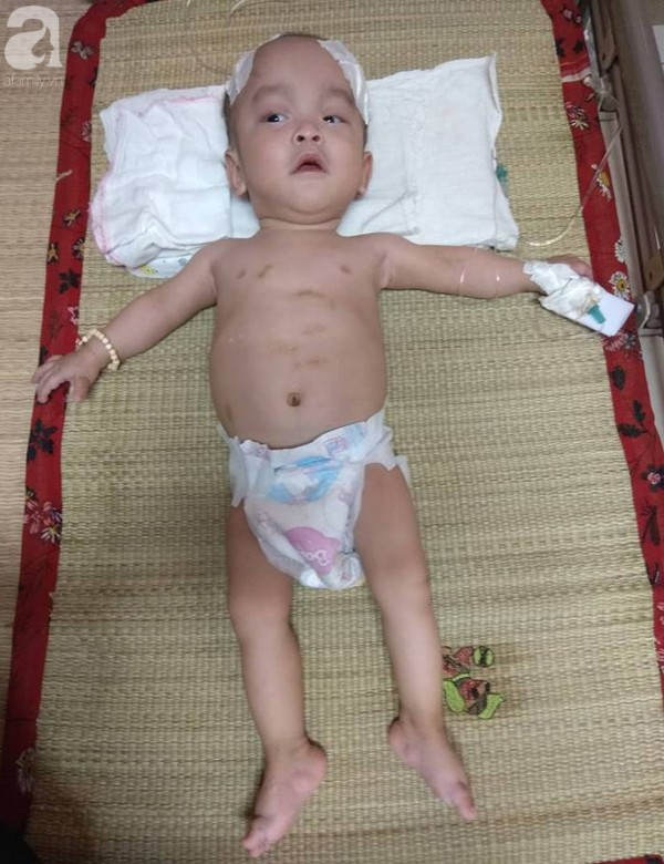 Sinh ra nặng chỉ 1kg, bé trai 14 tháng tuổi đau đớn chống chọi với căn bệnh quái ác   - Ảnh 2.