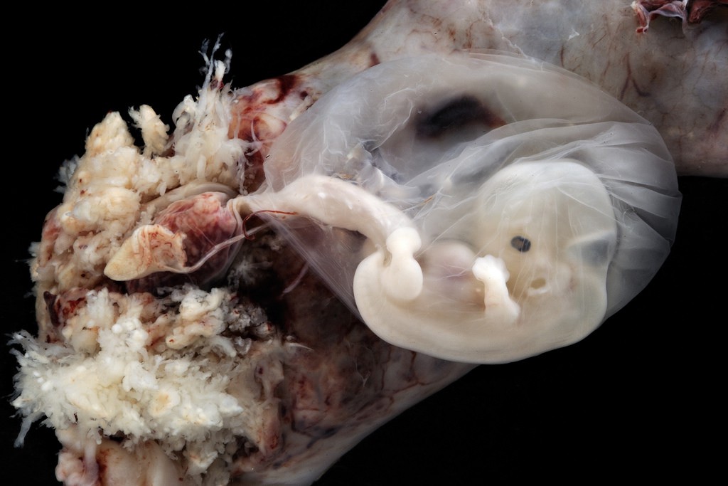 Những bức hình quý giá mô phỏng thai nhi phát triển trong bụng mẹ như một mầm sống kì diệu - Ảnh 11.
