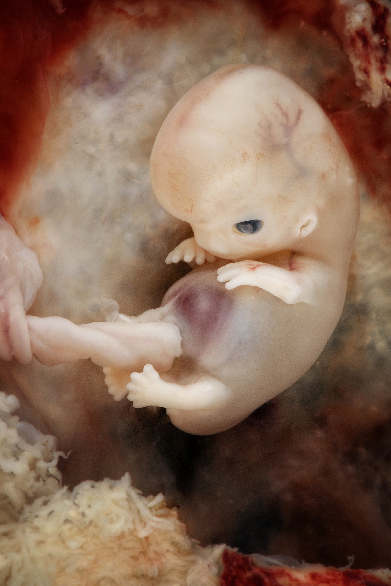 Những bức hình quý giá mô phỏng thai nhi phát triển trong bụng mẹ như một mầm sống kì diệu - Ảnh 12.
