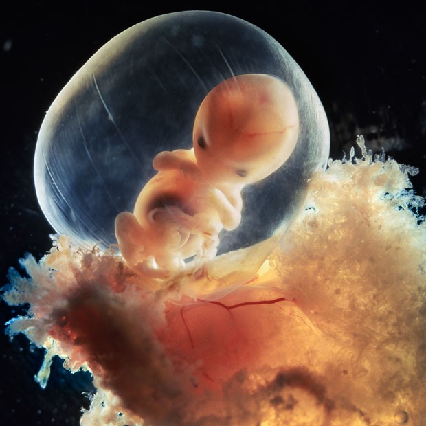 Những bức hình quý giá mô phỏng thai nhi phát triển trong bụng mẹ như một mầm sống kì diệu - Ảnh 13.
