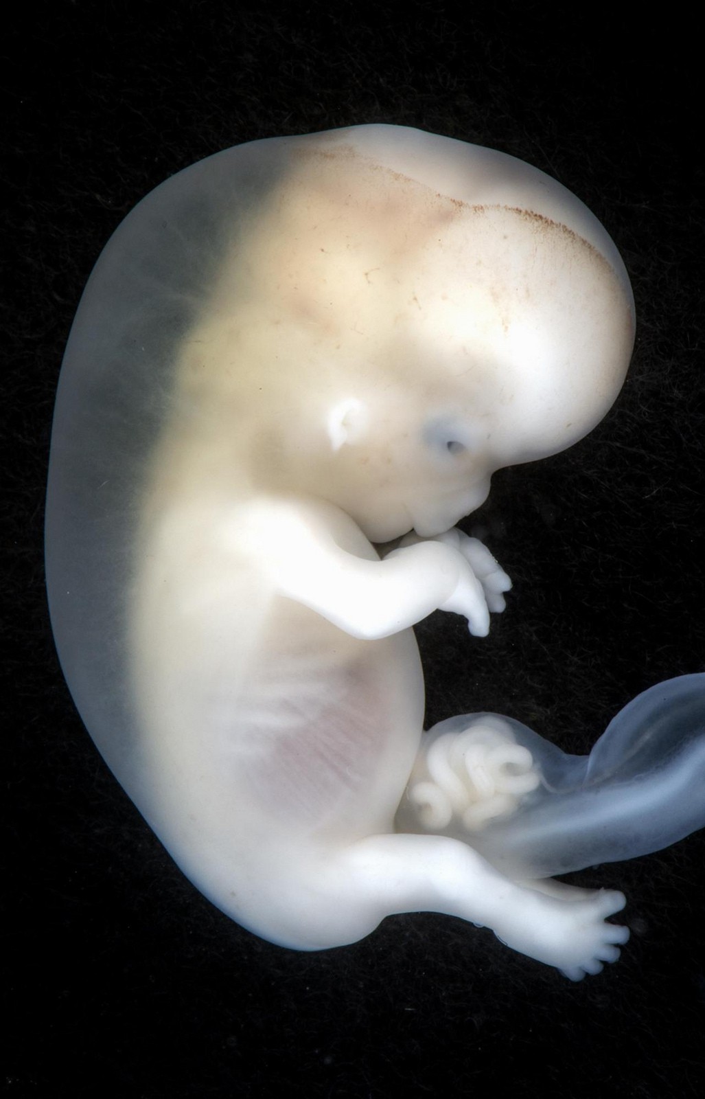 Những bức hình quý giá mô phỏng thai nhi phát triển trong bụng mẹ như một mầm sống kì diệu - Ảnh 15.