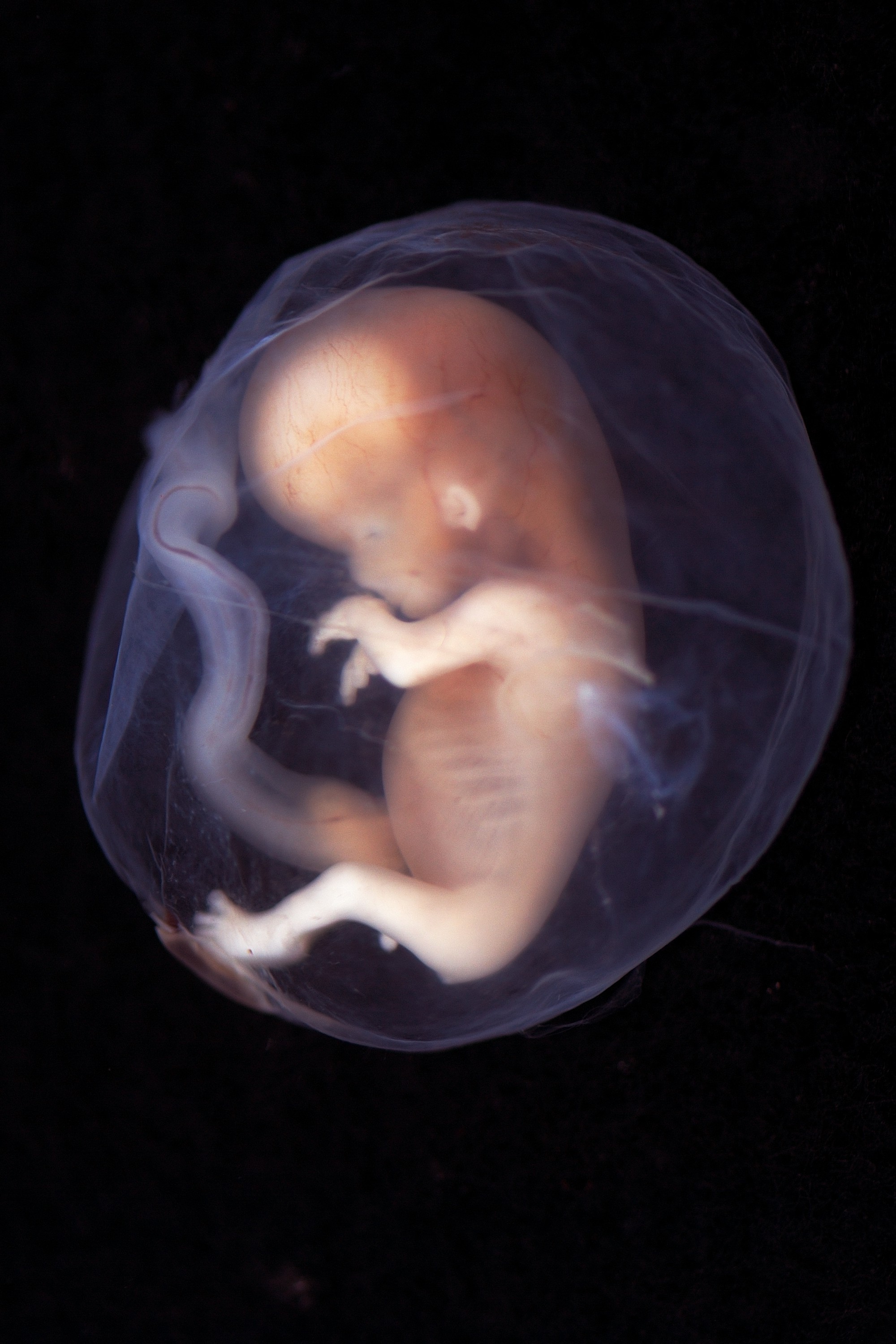 Những bức hình quý giá mô phỏng thai nhi phát triển trong bụng mẹ như một mầm sống kì diệu - Ảnh 16.