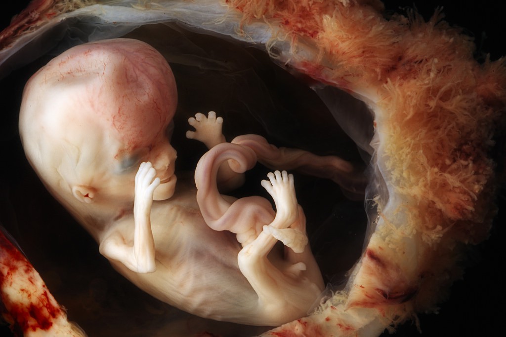 Những bức hình quý giá mô phỏng thai nhi phát triển trong bụng mẹ như một mầm sống kì diệu - Ảnh 17.