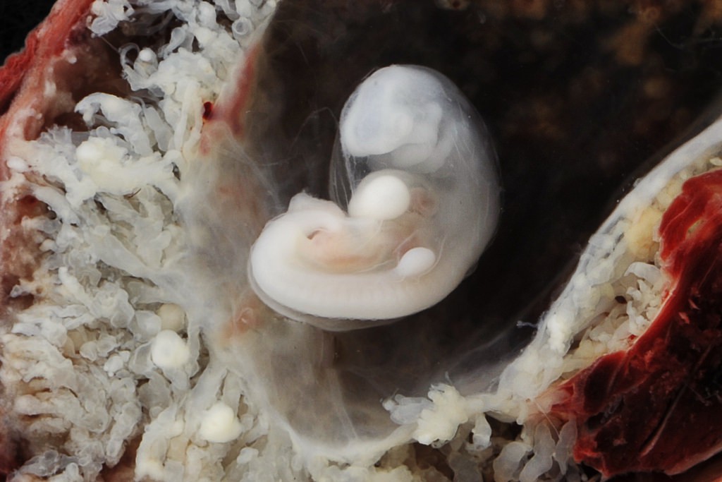 Những bức hình quý giá mô phỏng thai nhi phát triển trong bụng mẹ như một mầm sống kì diệu - Ảnh 3.