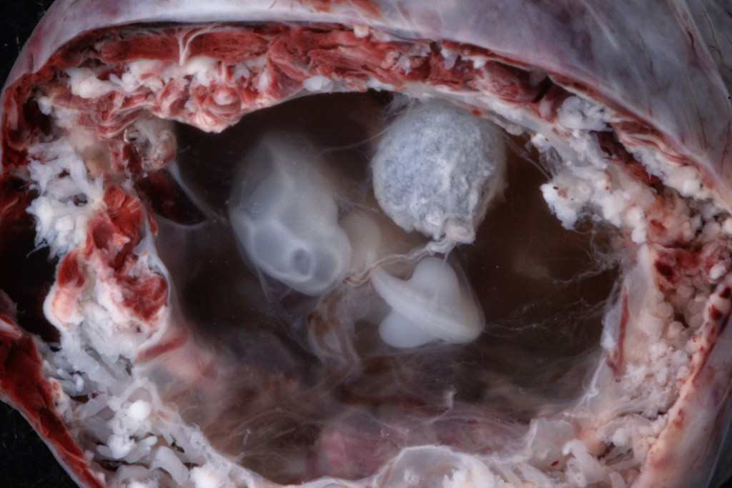 Những bức hình quý giá mô phỏng thai nhi phát triển trong bụng mẹ như một mầm sống kì diệu - Ảnh 4.