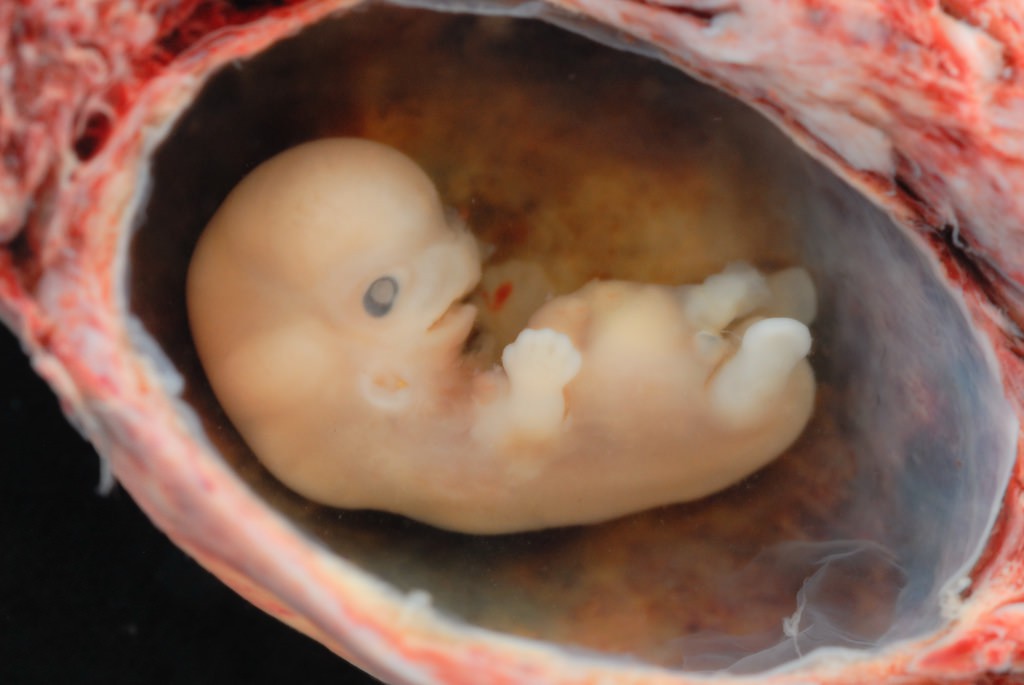 Những bức hình quý giá mô phỏng thai nhi phát triển trong bụng mẹ như một mầm sống kì diệu - Ảnh 5.