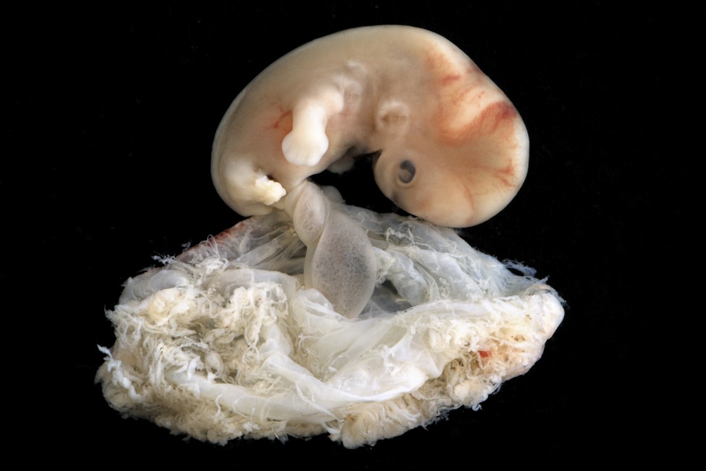 Những bức hình quý giá mô phỏng thai nhi phát triển trong bụng mẹ như một mầm sống kì diệu - Ảnh 6.