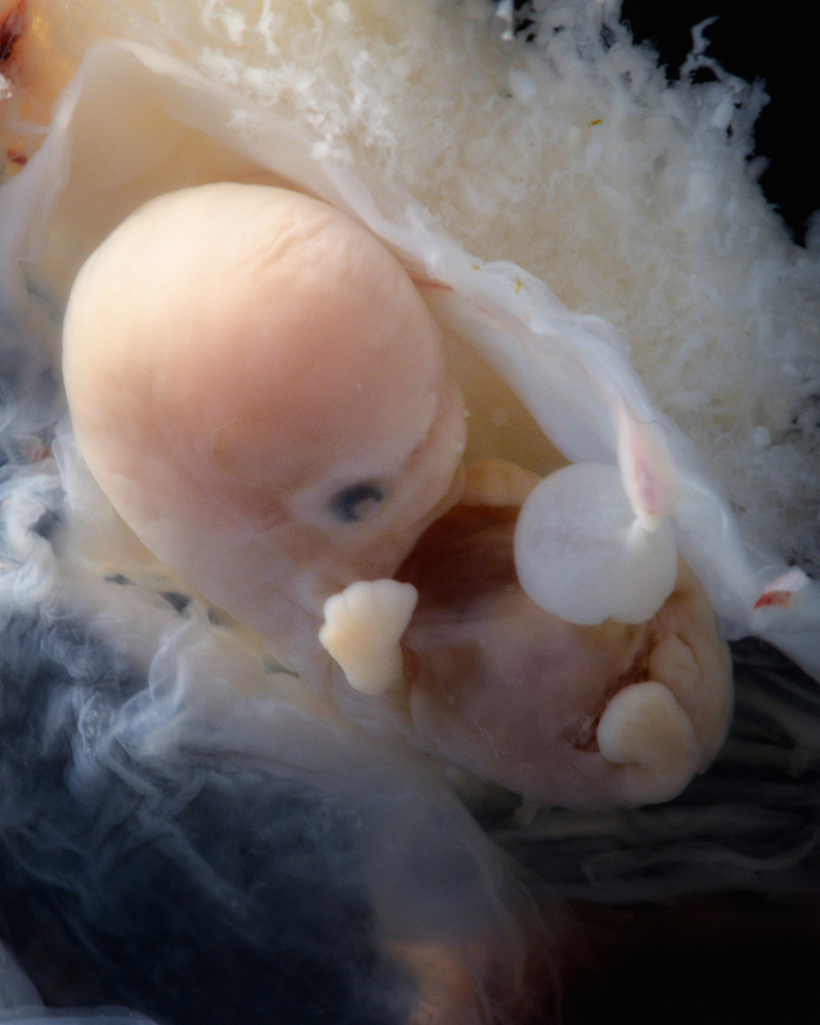 Những bức hình quý giá mô phỏng thai nhi phát triển trong bụng mẹ như một mầm sống kì diệu - Ảnh 7.