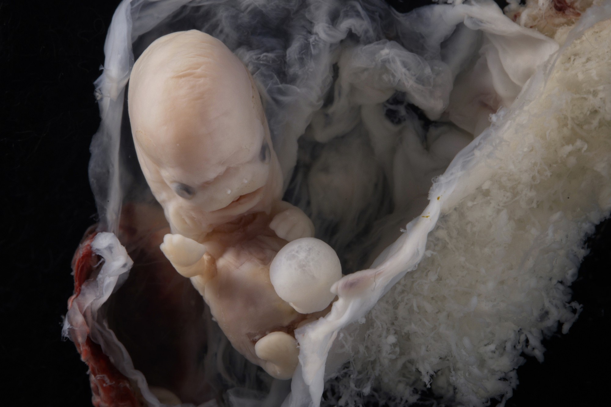 Những bức hình quý giá mô phỏng thai nhi phát triển trong bụng mẹ như một mầm sống kì diệu - Ảnh 8.