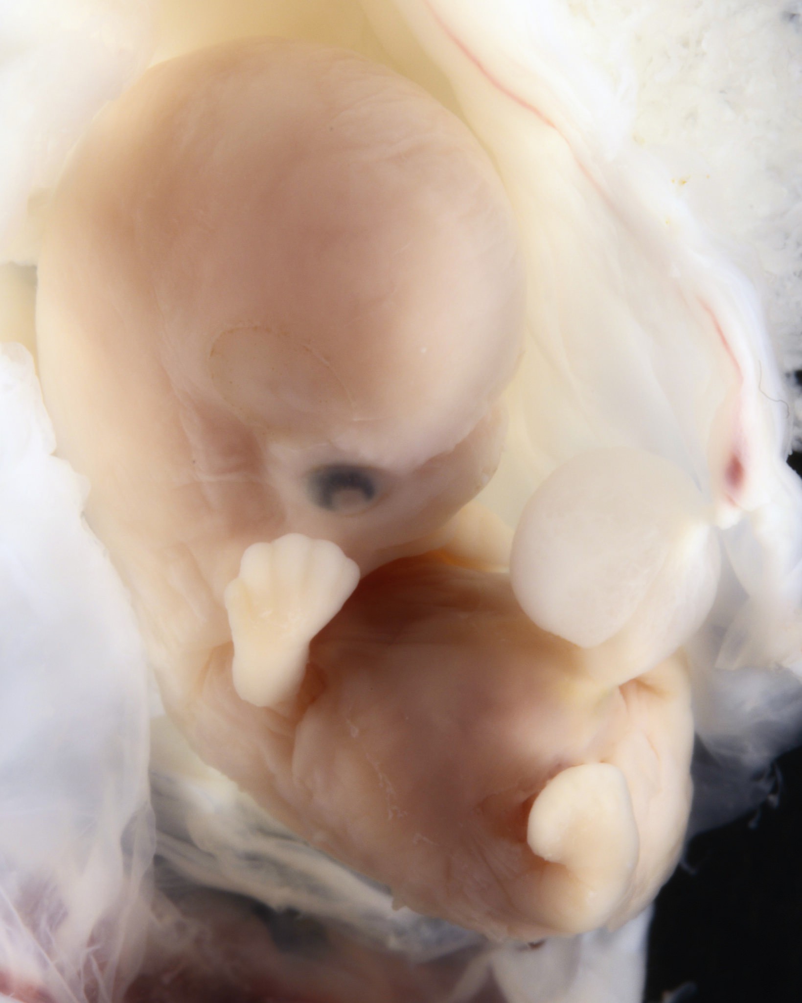 Những bức hình quý giá mô phỏng thai nhi phát triển trong bụng mẹ như một mầm sống kì diệu - Ảnh 9.