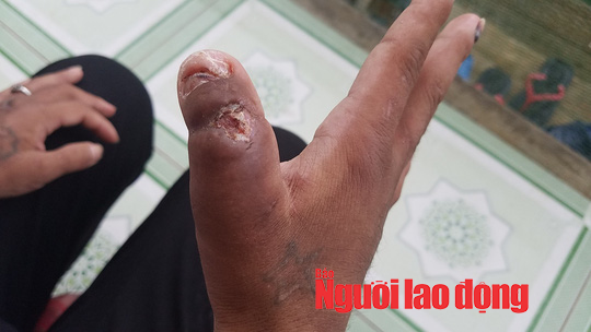 Vụ Nga vọc tra tấn dã man: Y Nhiêu khai gì với công an? - Ảnh 2. Vụ Nga vọc tra tấn dã man: Y Nhiêu khai gì với công an? - Ảnh 2.