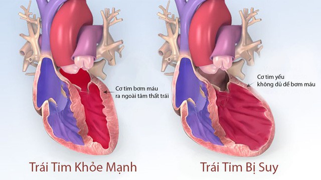 Trẻ dưới 10 tuổi mắc bệnh này sẽ bị giảm 20 năm tuổi thọ: Cha mẹ hãy chú ý phòng ngừa đúng - Ảnh 2. Trẻ dưới 10 tuổi mắc bệnh này sẽ bị giảm 20 năm tuổi thọ: Cha mẹ hãy chú ý phòng ngừa đúng - Ảnh 2.