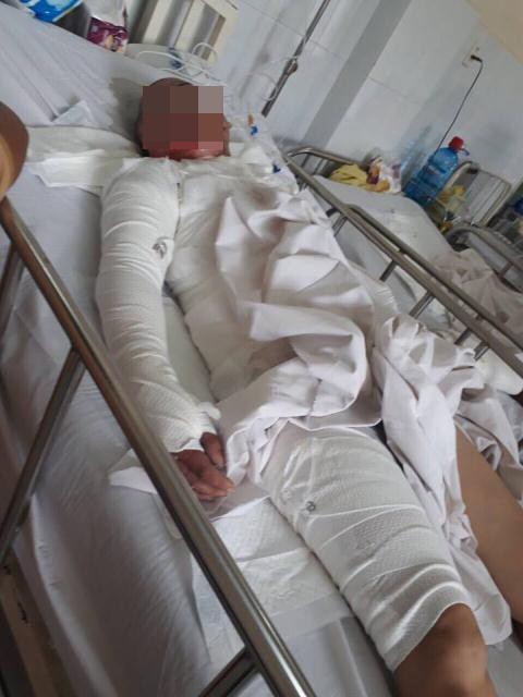 Bi kịch của người phụ nữ “hai lần đò” bị chồng thiêu sống - Ảnh 1. Bi kịch của người phụ nữ “hai lần đò” bị chồng thiêu sống - Ảnh 1.
