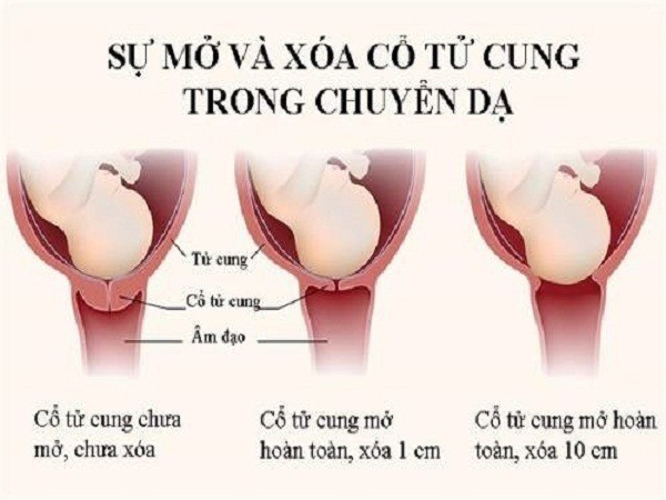 Chị em khăng khăng đòi đẻ mổ vì sợ cửa mình lỏng lẻo: Hãy nghe phân tích của chuyên gia - Ảnh 1.