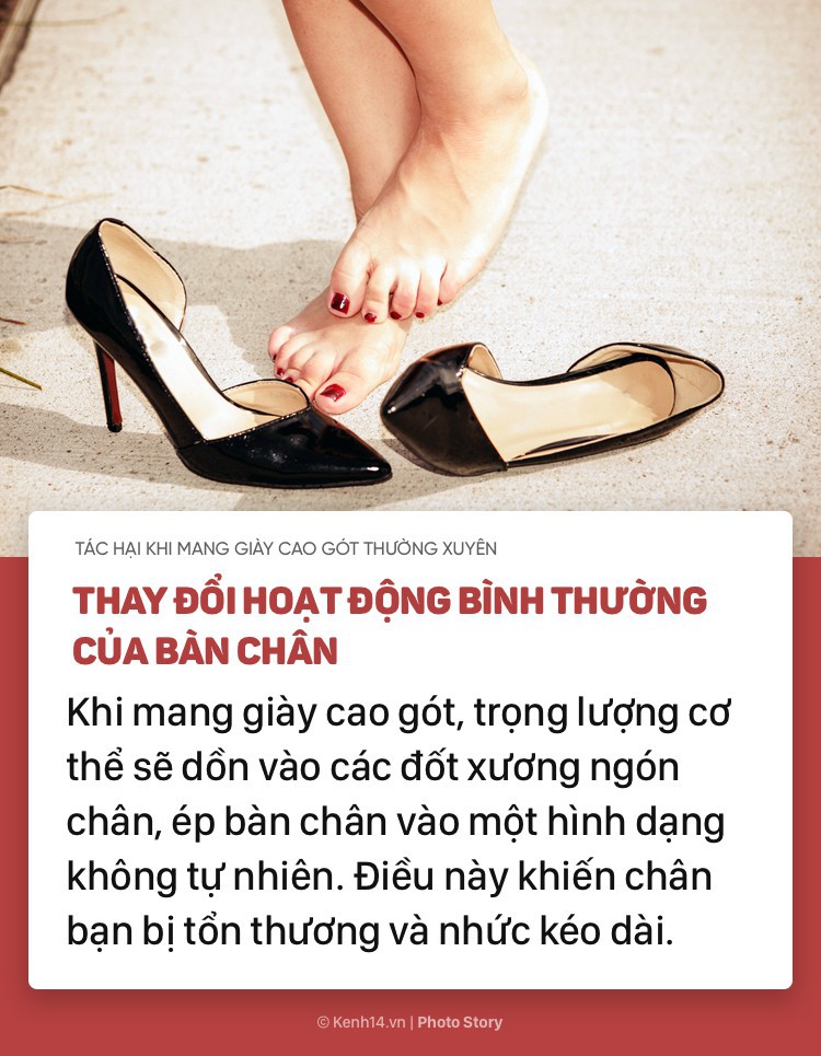 Nếu bạn thường xuyên mang giày cao gót, hãy chú ý những tác hại này - Ảnh 1.