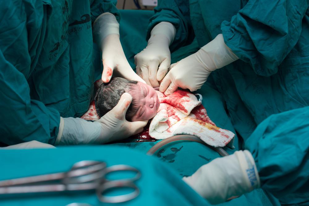 Bà mẹ đã nghĩ ra cách cực hay ho đáp trả lại quan niệm sinh mổ là không sinh con thực sự, làm mẹ thất bại - Ảnh 1. Bà mẹ đã nghĩ ra cách cực hay ho đáp trả lại quan niệm sinh mổ là không sinh con thực sự, làm mẹ thất bại - Ảnh 1.