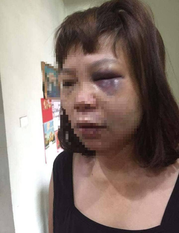 Dụ vợ lên đồi đánh đập dã man ở Quảng Ninh: Bắt tạm giam người chồng để điều tra - Ảnh 1.