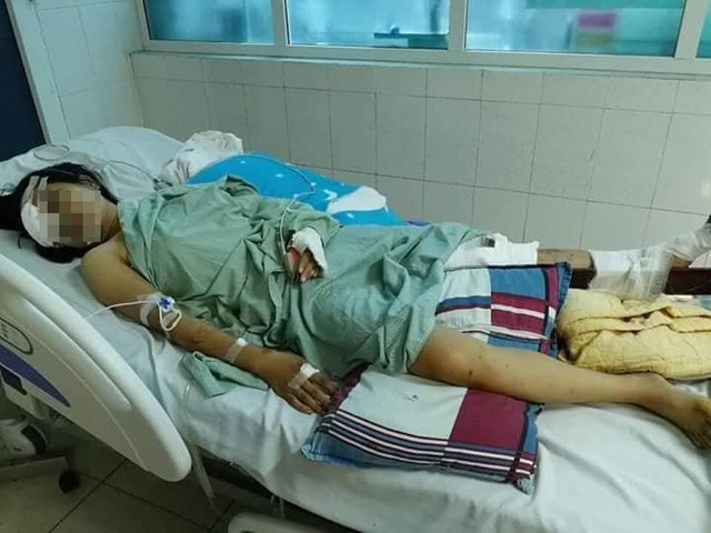 Vụ tai nạn giao thông khiến 13 người tử vong tại Lai Châu: Thoát cửa tử nhưng đối mặt với tận cùng nỗi đau - Ảnh 1. Vụ tai nạn giao thông khiến 13 người tử vong tại Lai Châu: Thoát cửa tử nhưng đối mặt với tận cùng nỗi đau - Ảnh 1.