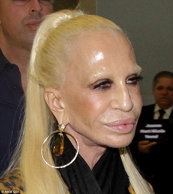 Mặt cứng đơ kém sắc, Lady Gaga bị nghi lạm dụng thẩm mỹ giống thảm họa dao kéo Donatella Versace - Ảnh 11.