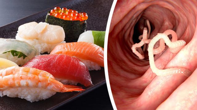 Tín đồ ăn sushi sẽ phát hoảng: Sán dây dài gần 2 mét sống trong bụng người đàn ông vì ăn sushi thường xuyên - Ảnh 1.