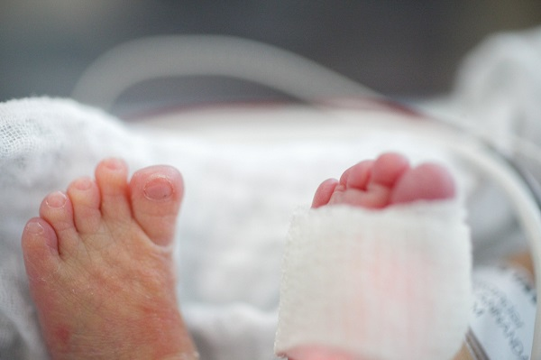 Thêm 1 bé sơ sinh suýt mất 2 ngón chân chỉ vì sợi tóc của mẹ - Ảnh 2.