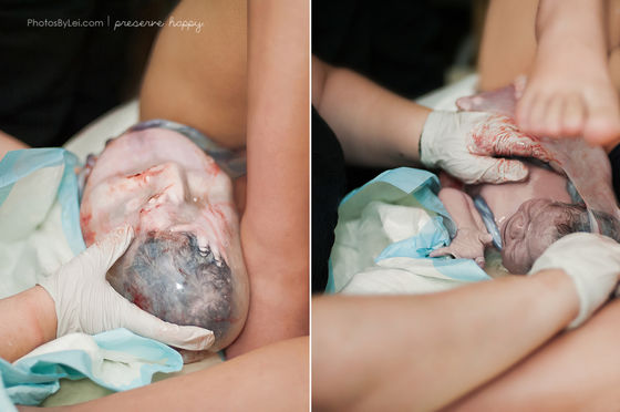Những bức ảnh sinh nở cực hiếm khi em bé chào đời còn nguyên trong túi ối - Ảnh 4.