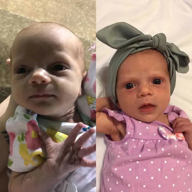 Thấy con cứ sụt c&acirc;n sau khi sinh d&ugrave; vẫn cho b&uacute; đầy đủ, b&agrave; mẹ bất ngờ khi biết nguy&ecirc;n nh&acirc;n - Ảnh 1.