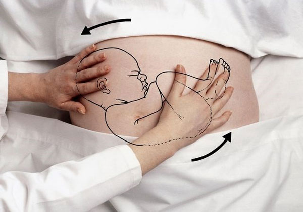 Những điều mẹ bầu cần biết khi được chẩn đoán có ngôi thai ngược   - Ảnh 4.