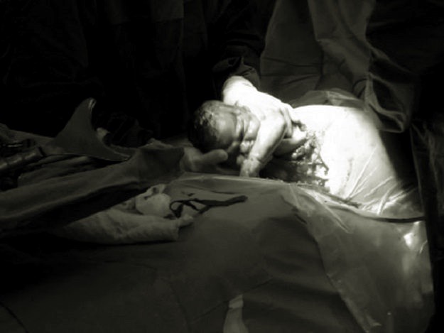 Em bé sơ sinh qua đời do vết cắt vào đầu trong quá trình sinh mổ - Ảnh 2.