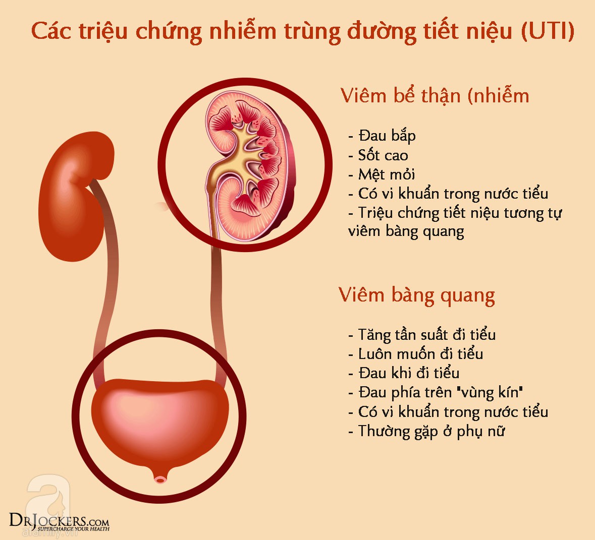 Dấu Hiệu Nhiễm Trùng Thận