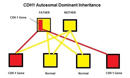 Dù đang rất khỏe mạnh, cô gái này quyết định phẫu thuật cắt bỏ toàn bộ dạ dày và bác sĩ nói cô đã làm đúng - Ảnh 5.