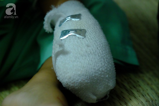 Tai nạn đau lòng: Bé trai 3 tuổi đứt lìa ba ngón tay vì nghịch máy xay bột làm nhang - Ảnh 5.