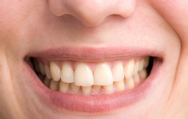 6 sai lầm kinh điển khiến răng ố vàng nhưng bạn vẫn vô tư làm mỗi ngày - Ảnh 1.