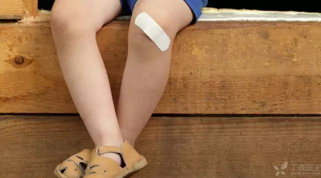 Bé 4 tuổi phải cắt cụt đầu ngón tay vì hoại tử do sai lầm của người lớn khi dùng miếng băng dán y tế - Ảnh 3.