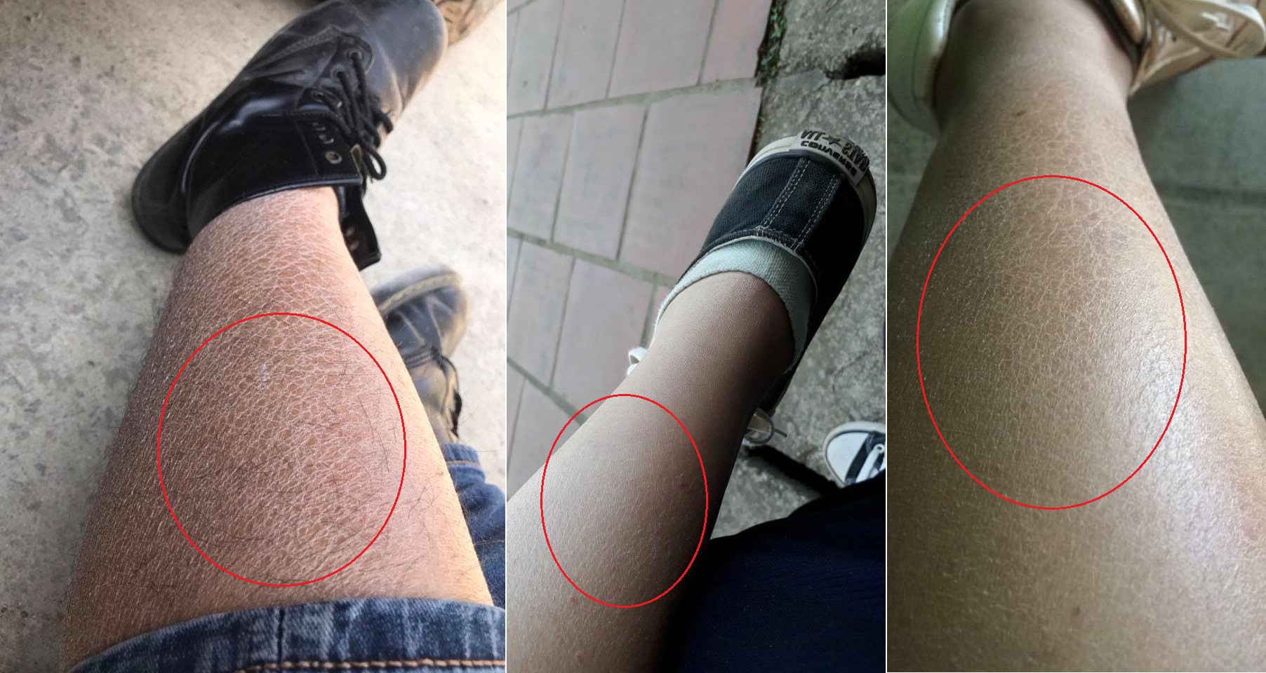 TUÝP KEM TRẮNG TRỊ DA RẮN CỦA NHẬT VỚI DÒNG CHỮ XANH NỔI BẬT