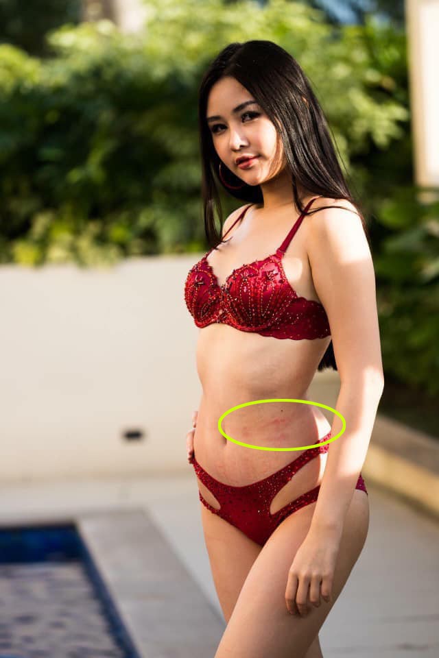 Mặc đồ lót tạo dáng bên bể bơi cho bộ ảnh... bikini, Lê Âu Ngân Anh còn để lộ vết tích lạ trên cơ thể - Ảnh 3.