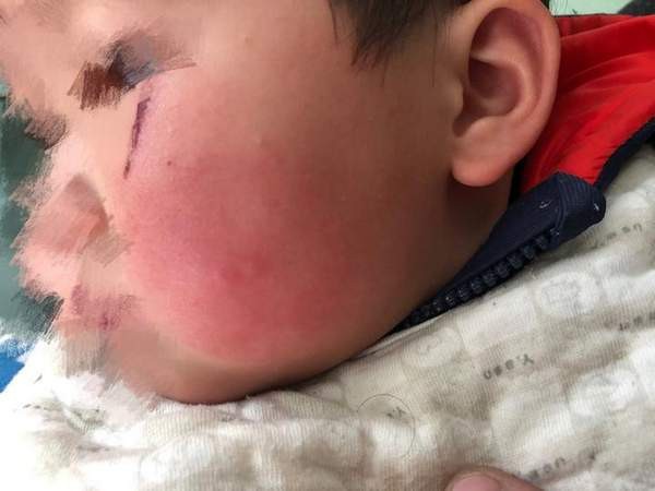 Vệ sinh sạch sẽ chục lần một ngày nhưng vùng kín cháu gái đỏ ửng, bà hoảng hốt nhận ra lỗi là ở chính mình - Ảnh 2. Vệ sinh sạch sẽ chục lần một ngày nhưng vùng kín cháu gái đỏ ửng, bà hoảng hốt nhận ra lỗi là ở chính mình - Ảnh 2.