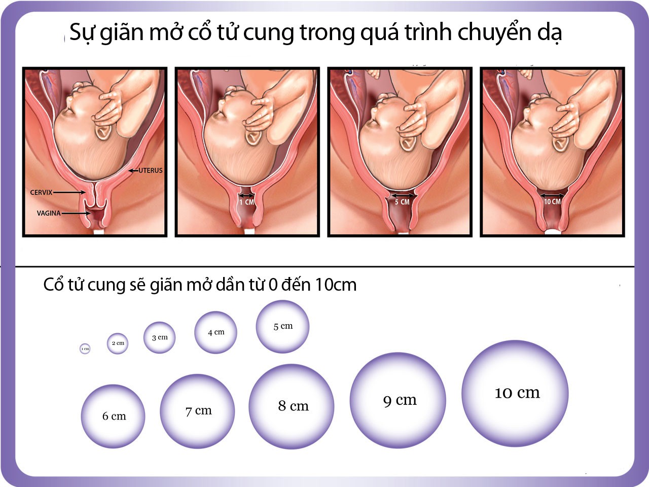 Mẹ nào cũng nói mở 10 phân sẽ đẻ nhưng không phải ai cũng biết mở ...