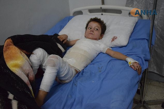 Dư luận quốc tế chấn động trước một loạt hình ảnh trẻ em Syria với những vết bỏng nặng, khoét sâu vào cơ thể do vũ khí hóa học gây ra - Ảnh 3.
