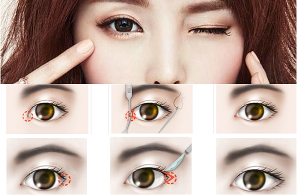 Review tất tần tật những phương pháp làm đẹp mắt đang gây bão giúp chị em sở hữu mắt đẹp tròn long lanh - Ảnh 4.